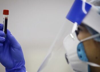 Медработник держит в руках пробирку с биоматериалом для тестирования на наличие антител к коронавирусу. Фото: Денис Абрамов/РИА Новости