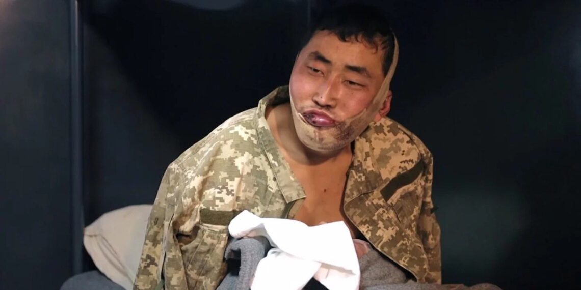 Один из пленных получил ранение в челюсь, а другой — перелом ноги