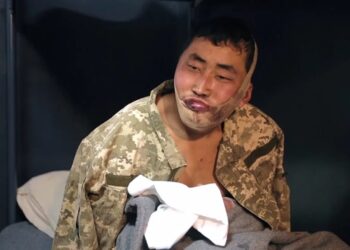 Один из пленных получил ранение в челюсь, а другой — перелом ноги